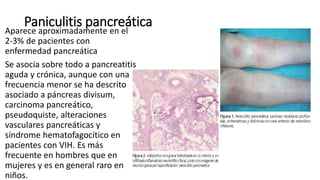 Paniculitis pancreática
Aparece aproximadamente en el
2-3% de pacientes con
enfermedad pancreática
Se asocia sobre todo a pancreatitis
aguda y crónica, aunque con una
frecuencia menor se ha descrito
asociado a páncreas divisum,
carcinoma pancreático,
pseudoquiste, alteraciones
vasculares pancreáticas y
síndrome hematofagocítico en
pacientes con VIH. Es más
frecuente en hombres que en
mujeres y es en general raro en
niños.
 