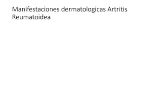Manifestaciones dermatologicas Artritis
Reumatoidea
 