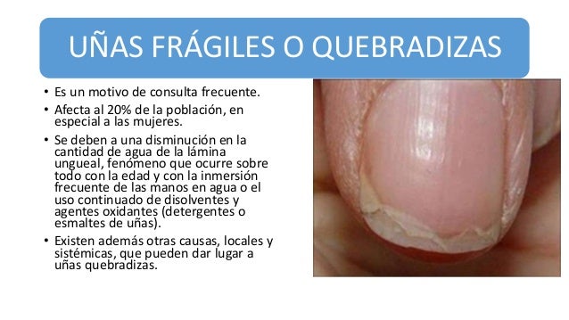 Las medicinas curar la psoriasis