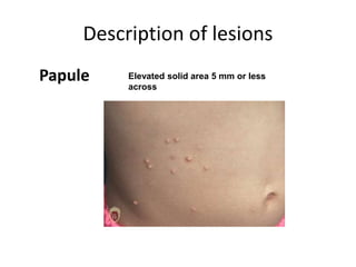 Dermatopathology1 | PPT