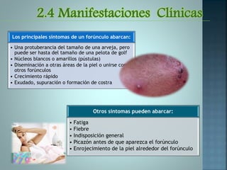 2.4 Manifestaciones Clínicas
Otros síntomas pueden abarcar:
• Fatiga
• Fiebre
• Indisposición general
• Picazón antes de que aparezca el forúnculo
• Enrojecimiento de la piel alrededor del forúnculo
Los principales síntomas de un forúnculo abarcan:
• Una protuberancia del tamaño de una arveja, pero
puede ser hasta del tamaño de una pelota de golf
• Núcleos blancos o amarillos (pústulas)
• Diseminación a otras áreas de la piel o unirse con
otros forúnculos
• Crecimiento rápido
• Exudado, supuración o formación de costra
 