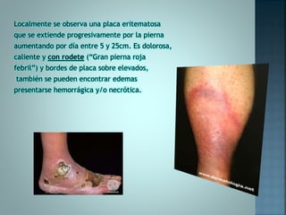 Localmente se observa una placa eritematosa
que se extiende progresivamente por la pierna
aumentando por día entre 5 y 25cm. Es dolorosa,
caliente y con rodete (“Gran pierna roja
febril”) y bordes de placa sobre elevados,
también se pueden encontrar edemas
presentarse hemorrágica y/o necrótica.
 