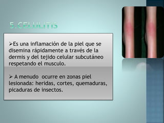 Es una inflamación de la piel que se
disemina rápidamente a través de la
dermis y del tejido celular subcutáneo
respetando el musculo.
 A menudo ocurre en zonas piel
lesionada: heridas, cortes, quemaduras,
picaduras de insectos.
 