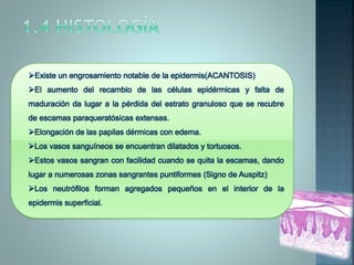 Existe un engrosamiento notable de la epidermis(ACANTOSIS)
El aumento del recambio de las células epidérmicas y falta de
maduración da lugar a la pérdida del estrato granuloso que se recubre
de escamas paraqueratósicas extensas.
Elongación de las papilas dérmicas con edema.
Los vasos sanguíneos se encuentran dilatados y tortuosos.
Estos vasos sangran con facilidad cuando se quita la escamas, dando
lugar a numerosas zonas sangrantes puntiformes (Signo de Auspitz)
Los neutrófilos forman agregados pequeños en el interior de la
epidermis superficial.
 