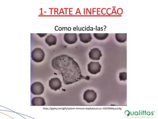 1- TRATE A INFECÇÃO
Como elucida-las?
https://giphy.com/gifs/system-immune-staphylococcus-10J03NWquceLKg
 
