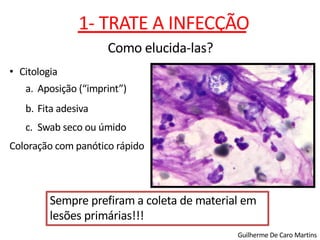 Guilherme De Caro Martins
• Citologia
a. Aposição (“imprint”)
b. Fita adesiva
c. Swab seco ou úmido
Coloração com panótico rápido
1- TRATE A INFECÇÃO
Como elucida-las?
Sempre prefiram a coleta de material em
lesões primárias!!!
 