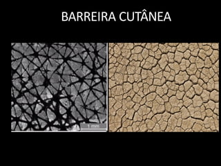 BARREIRA CUTÂNEA
 