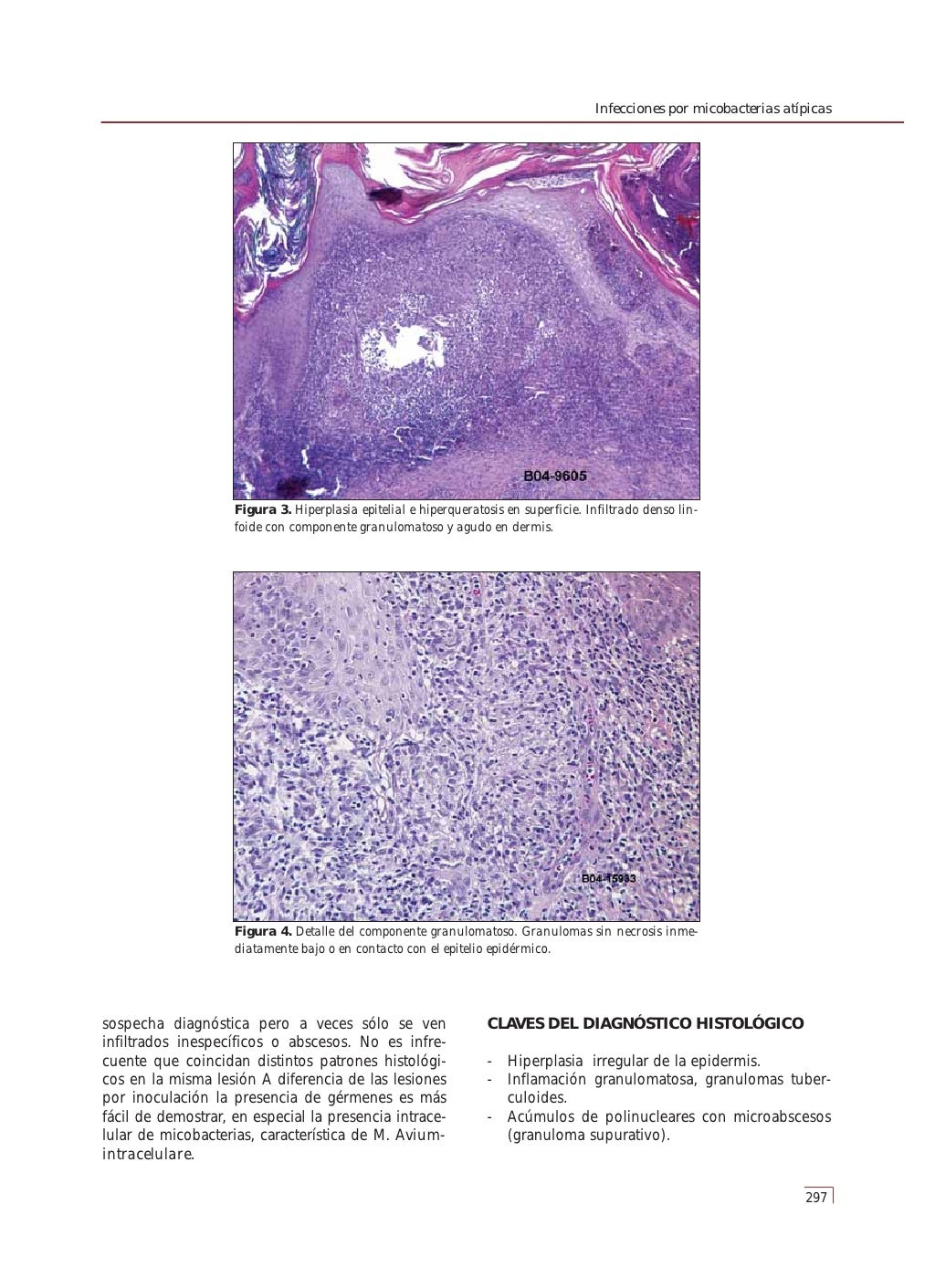 Dermatopatología correlación clínico patológica