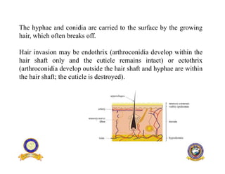 Dermatophyte malassezia | PDF