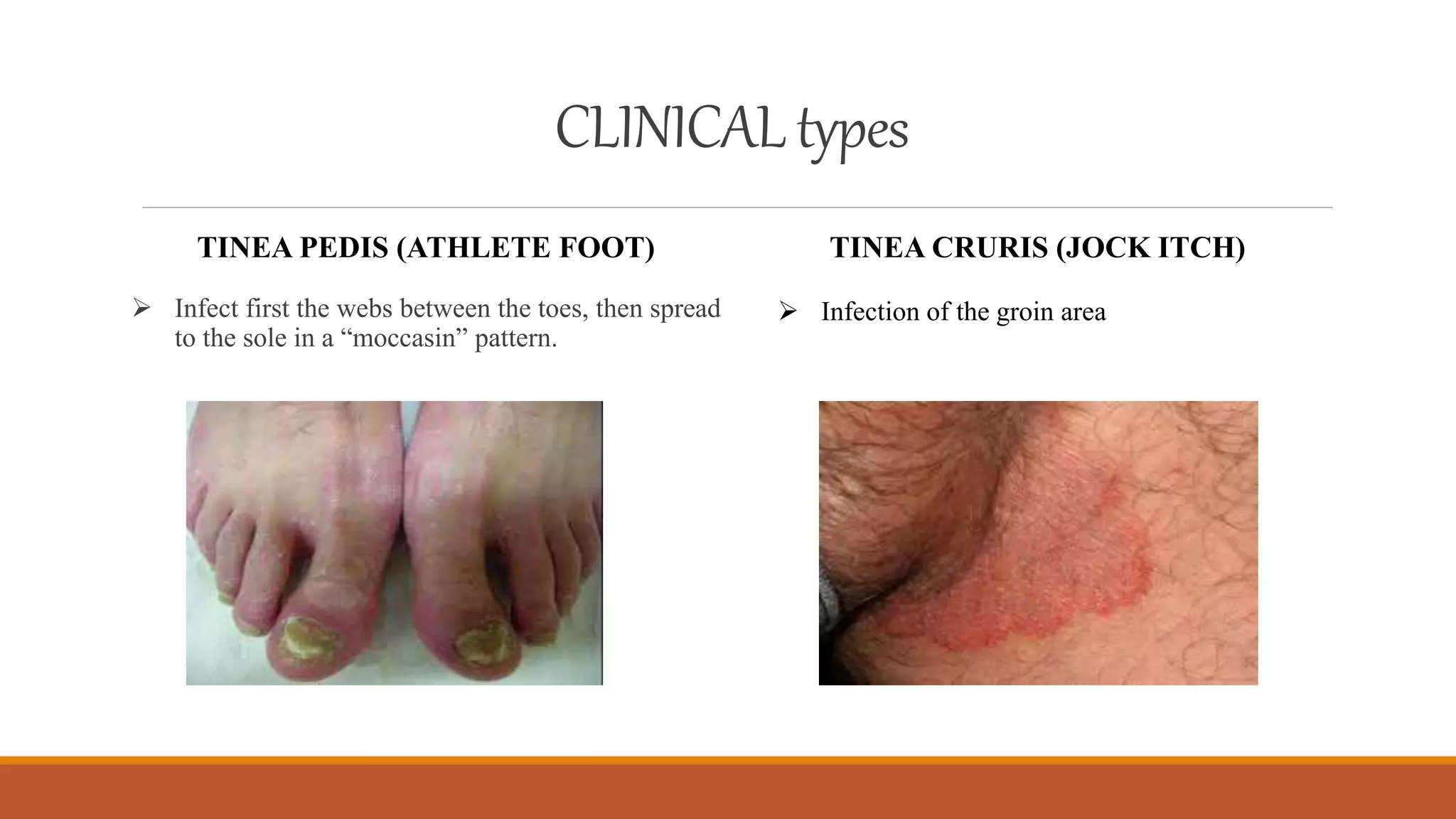 Dermatophytes | PPTX