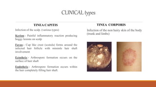 Dermatophytes | PPTX