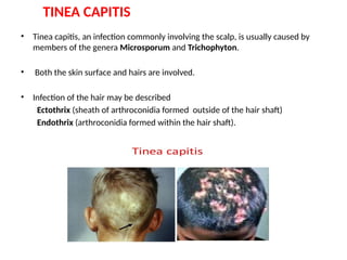 Dermatophytes.pptxnsksigsiwkshwowjbeksowkj | PPTX