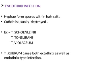 Dermatophytes.pptxnsksigsiwkshwowjbeksowkj | PPTX