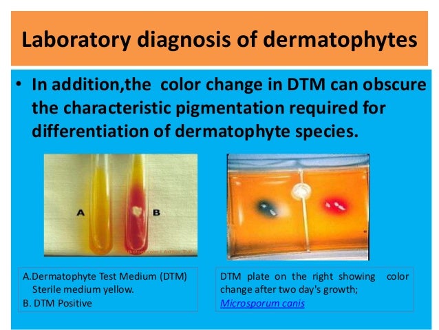 Dermatophyte Identification Chart