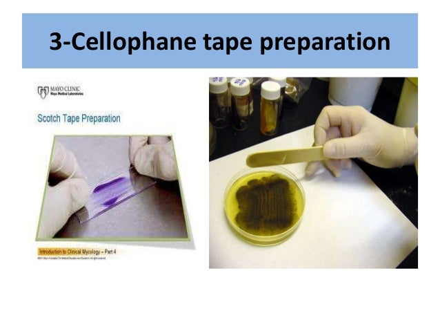 Dermatophytes undergraduates