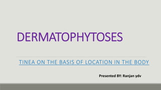 DERMATOPHYTOSES
TINEA ON THE BASIS OF LOCATION IN THE BODY
Presented BY: Ranjan ydv
 