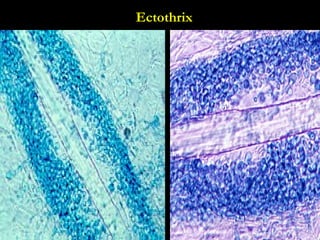 dermatophytosis .ppt