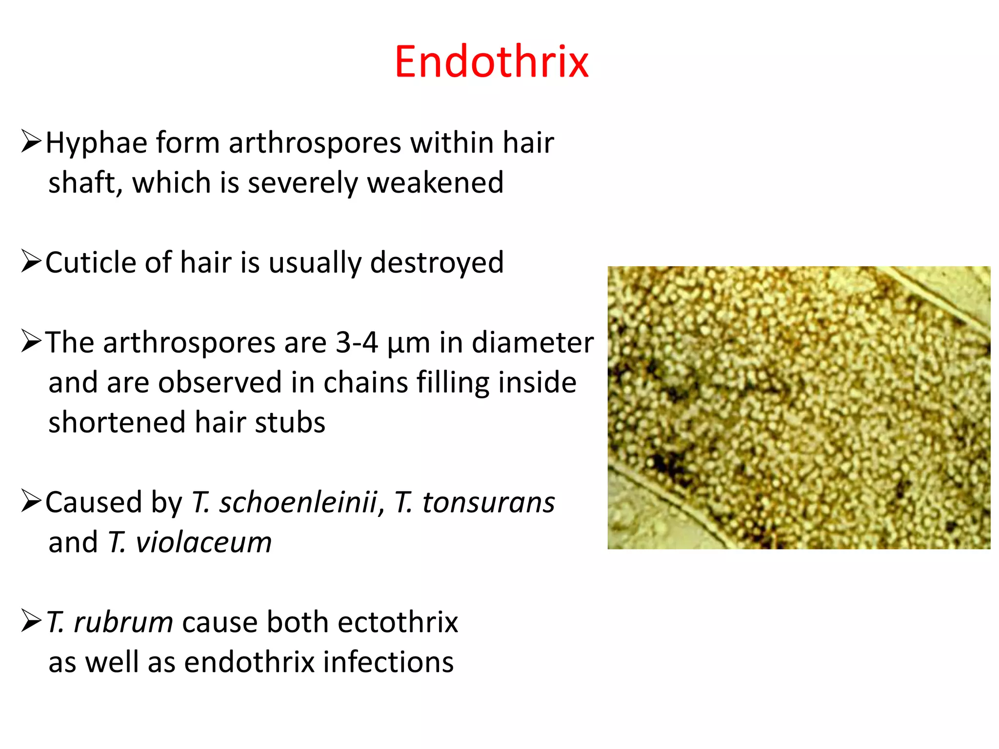 Endotrix Dermatophytosis, raghu | PPTX