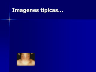 Imagenes tipicas…
 