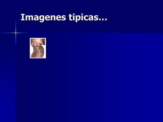 Imagenes tipicas…
 