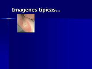 Imagenes tipicas…
 