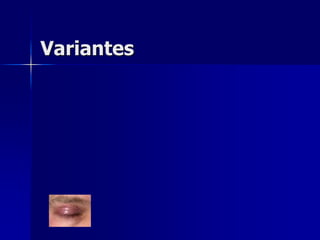 Variantes
 
