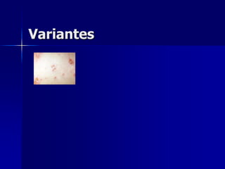 Variantes
 