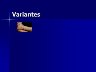 Variantes
 