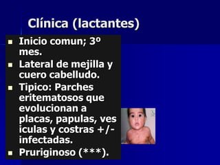 Clínica (lactantes)
   Inicio comun; 3º
    mes.
   Lateral de mejilla y
    cuero cabelludo.
   Tipico: Parches
    eritematosos que
    evolucionan a
    placas, papulas, ves
    iculas y costras +/-
    infectadas.
   Pruriginoso (***).
 