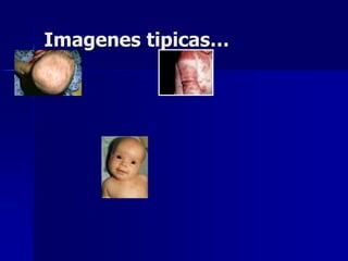 Imagenes tipicas…
 