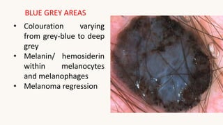 Grey Blue Rash Dermatoscope and its application in dermatology | PPTX