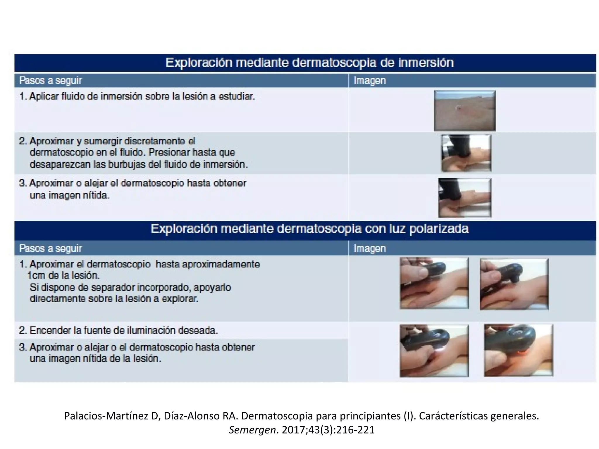 Dermatoscopia En Atenci n Primaria PPT dermatoscopia-en-atenci-n-primaria-ppt
