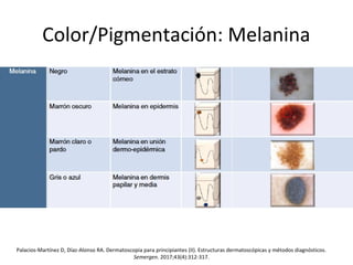 Color/Pigmentación: Melanina
Palacios-Martínez D, Díaz-Alonso RA. Dermatoscopia para principiantes (II). Estructuras dermatoscópicas y métodos diagnósticos.
Semergen. 2017;43(4):312-317.
 