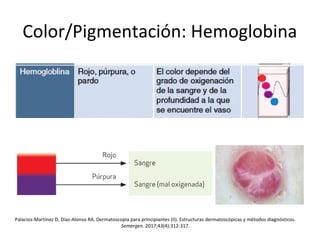 Color/Pigmentación: Hemoglobina
Palacios-Martínez D, Díaz-Alonso RA. Dermatoscopia para principiantes (II). Estructuras dermatoscópicas y métodos diagnósticos.
Semergen. 2017;43(4):312-317.
 