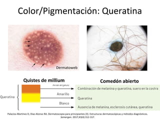 Color/Pigmentación: Queratina
Quistes de millium Comedón abierto
Palacios-Martínez D, Díaz-Alonso RA. Dermatoscopia para principiantes (II). Estructuras dermatoscópicas y métodos diagnósticos.
Semergen. 2017;43(4):312-317.
Dermatoweb
 