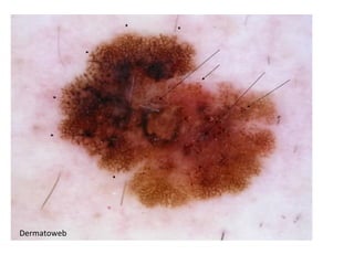 Dermatoweb
 
