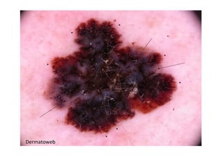 Dermatoweb
 