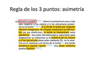 Regla de los 3 puntos: asimetría
 