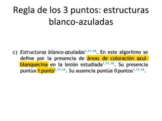 Regla de los 3 puntos: estructuras
blanco-azuladas
 