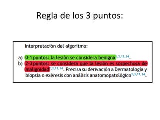 Regla de los 3 puntos:
 