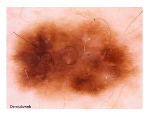 Dermatoweb
 