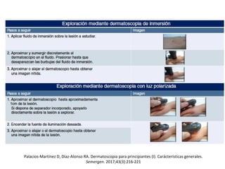 Palacios-Martínez D, Díaz-Alonso RA. Dermatoscopia para principiantes (I). Carácterísticas generales.
Semergen. 2017;43(3):216-221
 