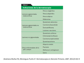 Alcántara-Muñoz PA, Menárguez-Puche JF. Dermatoscopia en Atención Primaria. AMF. 2013;9:331-9
 
