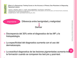  Diferencia entre benignidad y malignidad
Derivar
 Discrepancia del 30% entre el diagnostico de los MF y la
histopatolog...