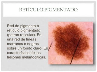 Dermatoscopia Parte1 PPTX dermatoscopia-parte1-pptx