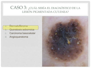 Dermatoscopia parte1 | PPTX