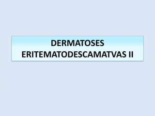 DERMATOSES
ERITEMATODESCAMATVAS II
 