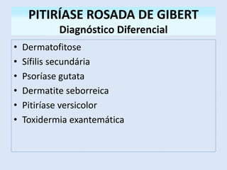 PITIRÍASE ROSADA DE GIBERT
Diagnóstico Diferencial
• Dermatofitose
• Sífilis secundária
• Psoríase gutata
• Dermatite seborreica
• Pitiríase versicolor
• Toxidermia exantemática
 