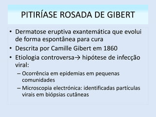 PITIRÍASE ROSADA DE GIBERT
• Dermatose eruptiva exantemática que evolui
de forma espontânea para cura
• Descrita por Camille Gibert em 1860
• Etiologia controversa→ hipótese de infecção
viral:
– Ocorrência em epidemias em pequenas
comunidades
– Microscopia electrónica: identificadas partículas
virais em biópsias cutâneas
 