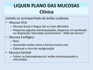 LIQUEN PLANO DAS MUCOSAS
Clínica
Isolado ou acompanhado de lesões cutâneas
• Mucosa Oral
– Mucosa bucal e língua são as mais afectadas
– Pequenas pápulas esbranquiçadas, dispersas em ponteado
ou disposição reticulada característica ‟ folha de avenca ″
• Mucosa Esofágica
– Rara
– Associada muitas vezes a forma erosiva oral
– Estenose e risco de malignização
• Mucosa Genital
– Vulvar ou balanoprepucial: lesões esbranquiçadas e
reticuladas
 